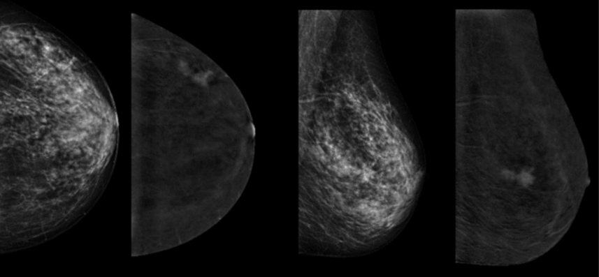 Nuova funzione disponibile: Contrast Enhancement Visualization